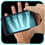 Xray Scanner