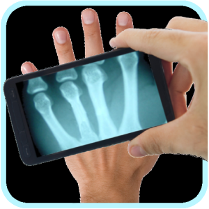 Xray Scanner